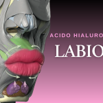 Curso de aplicación de ácido hialurónico para labios