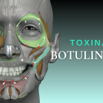 Curso de aplicación de Toxina Botulínica