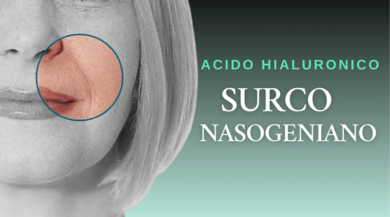 Curso Acido hialuronico surco nasogeniano