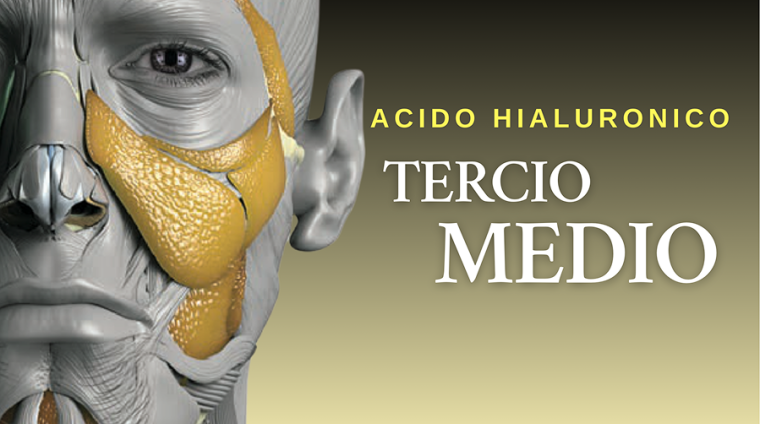 Curso Acido hialuronico tercio medio