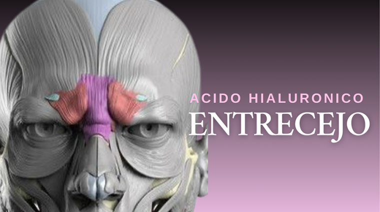 Curso acido hialuronico entrecejo