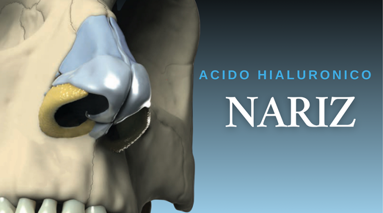 Curso acido hialuronico para nariz